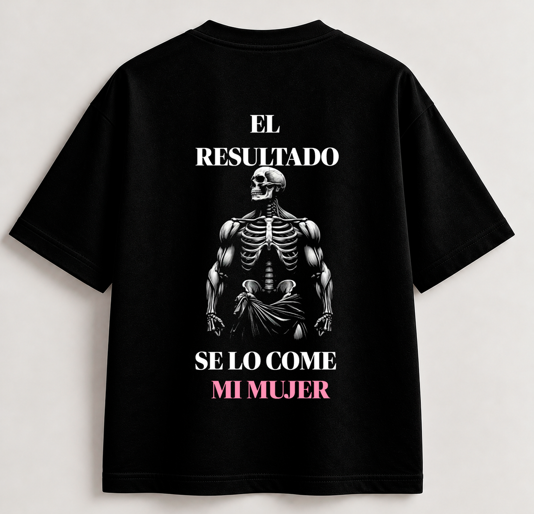EL RESULTADO – Camiseta Oversize